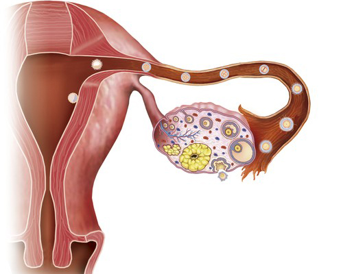 uterine_cancer_03