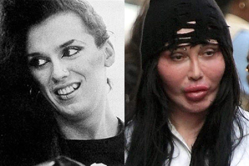 Pete Burns