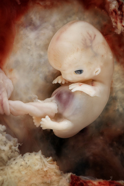 7-8-week-old-fetus_9-10-week-pregnancy